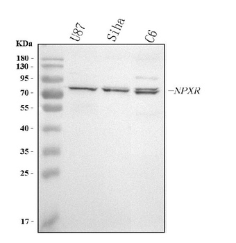 Anti-NPTXR Antibody