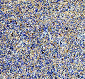 Anti-NPTXR Antibody