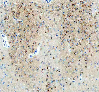 Anti-NPTXR Antibody