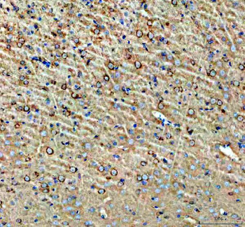 Anti-NPTXR Antibody