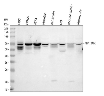 Anti-NPTXR Antibody