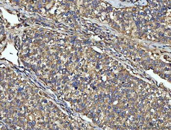Anti-NPEPPS Antibody