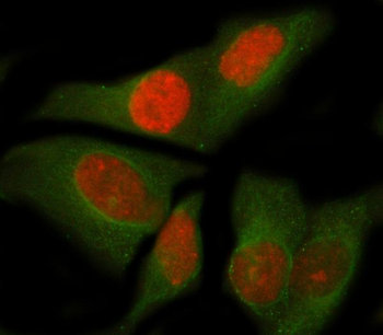 Anti-NOC4L Antibody