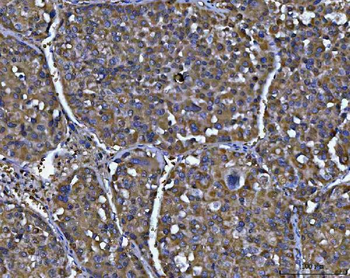Anti-NIT2 Antibody