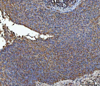 Anti-NIT2 Antibody