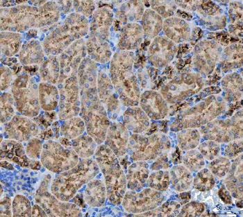 Anti-NIT2 Antibody