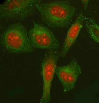Anti-NCOA5 Antibody