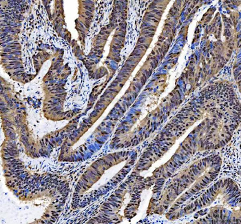 Anti-NCOA5 Antibody