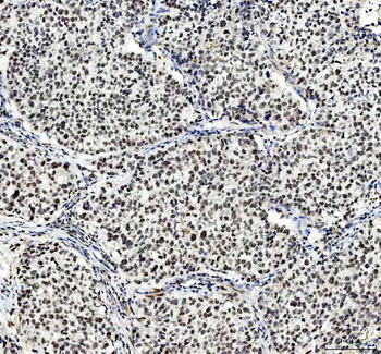 Anti-NCOA5 Antibody