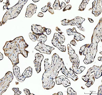 Anti-NCOA5 Antibody