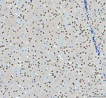 Anti-NCOA5 Antibody