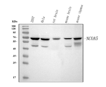 Anti-NCOA5 Antibody