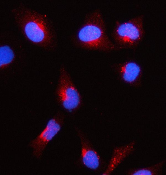 Anti-ACAT1 Antibody