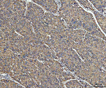 Anti-ACAT1 Antibody