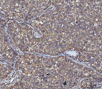 Anti-ACAT1 Antibody