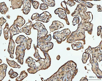 Anti-ACAT1 Antibody