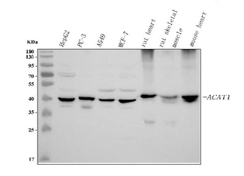 Anti-ACAT1 Antibody