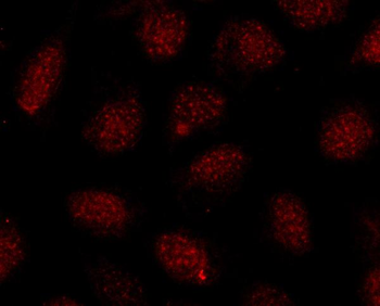 Anti-SOX10 Antibody