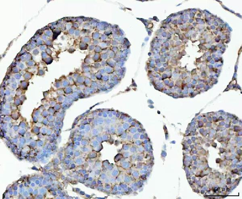 Anti-GHRH Antibody
