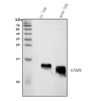 Anti-GHRH Antibody