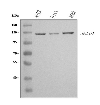 Anti-NAT10 Antibody