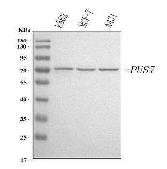 Anti-PUS7 Antibody