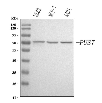 Anti-PUS7 Antibody