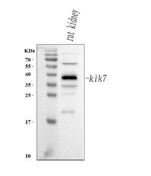 Anti-Klk7 Antibody