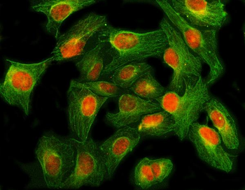 Anti-GLI2 Antibody