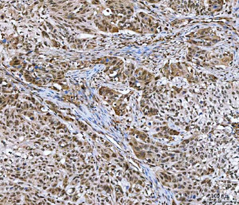 Anti-GLI2 Antibody