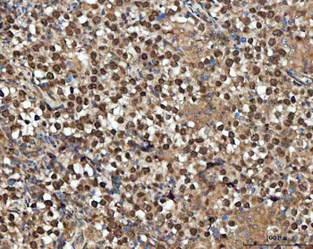 Anti-GLI2 Antibody