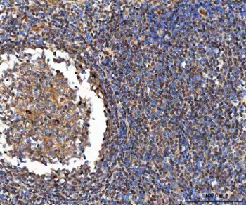 Anti-GLI2 Antibody