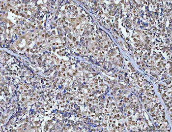 Anti-CHD8 Antibody