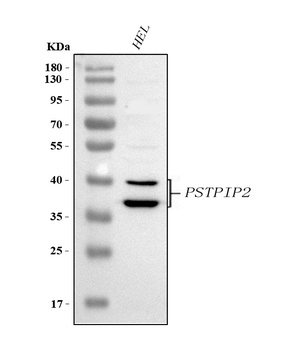 Anti-PSTPIP2 Antibody