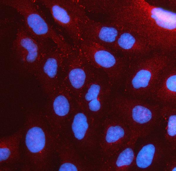 Anti-PSTPIP2 Antibody
