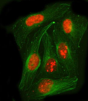 Anti-PSPC1 Antibody
