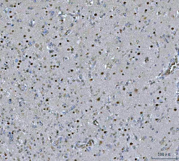 Anti-PSPC1 Antibody