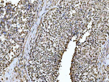 Anti-PSPC1 Antibody