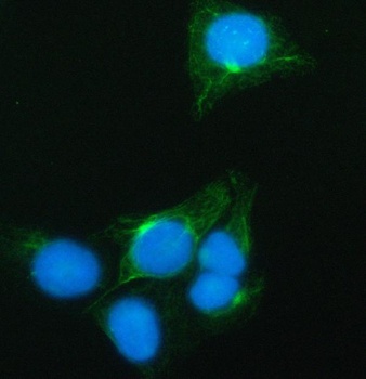 Anti-SynDIG4/PRRT1 Antibody