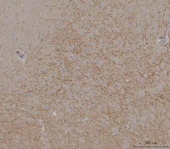 Anti-SynDIG4/PRRT1 Antibody