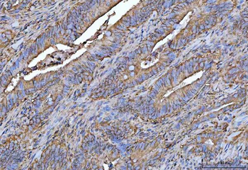 PROSER3 Rabbit Polyclonal Antibody