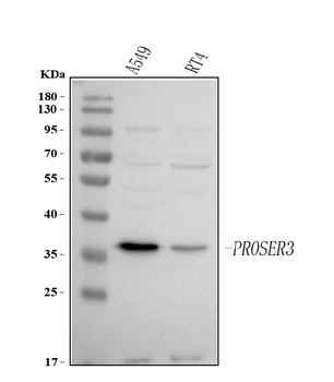 PROSER3 Rabbit Polyclonal Antibody