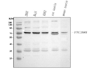 Anti-TTC39B Antibody