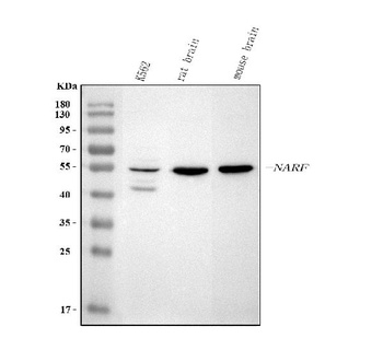 Anti-NARF Antibody