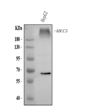 Anti-ABCC3 Antibody