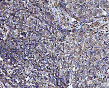 Anti-PRMT7 Antibody