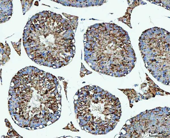 Anti-PRMT7 Antibody