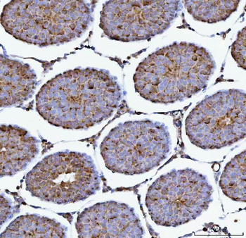 Anti-PRMT7 Antibody