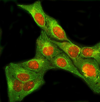 Anti-SIX4 Antibody