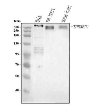 TP53BP1 Antibody